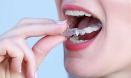 Schienenbehandlung eine Leistung der Zahnarztpraxis Dr. Thomas Dietrich 