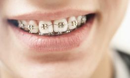 Kieferorthopädie eine Leistung der Zahnarztpraxis Dr. Thomas Dietrich 