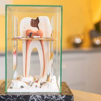 Ein nachgebildeter 3D-Zahn - ein Bild aus der Zahnarztpraxis Dr. Thomas Dietrich 