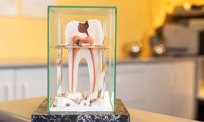 Ein nachgebildeter 3D-Zahn - ein Bild aus der Zahnarztpraxis Dr. Thomas Dietrich 