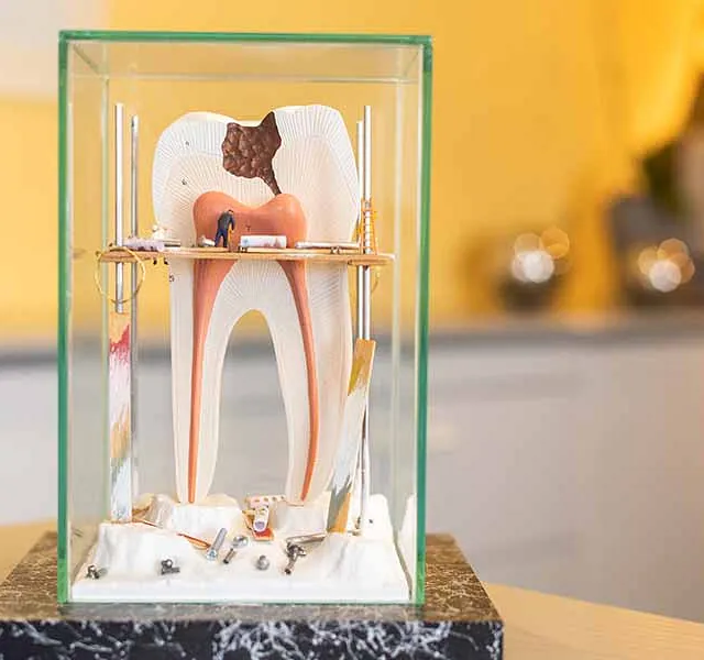 Ein nachgebildeter 3D-Zahn - ein Bild aus der Zahnarztpraxis Dr. Thomas Dietrich 